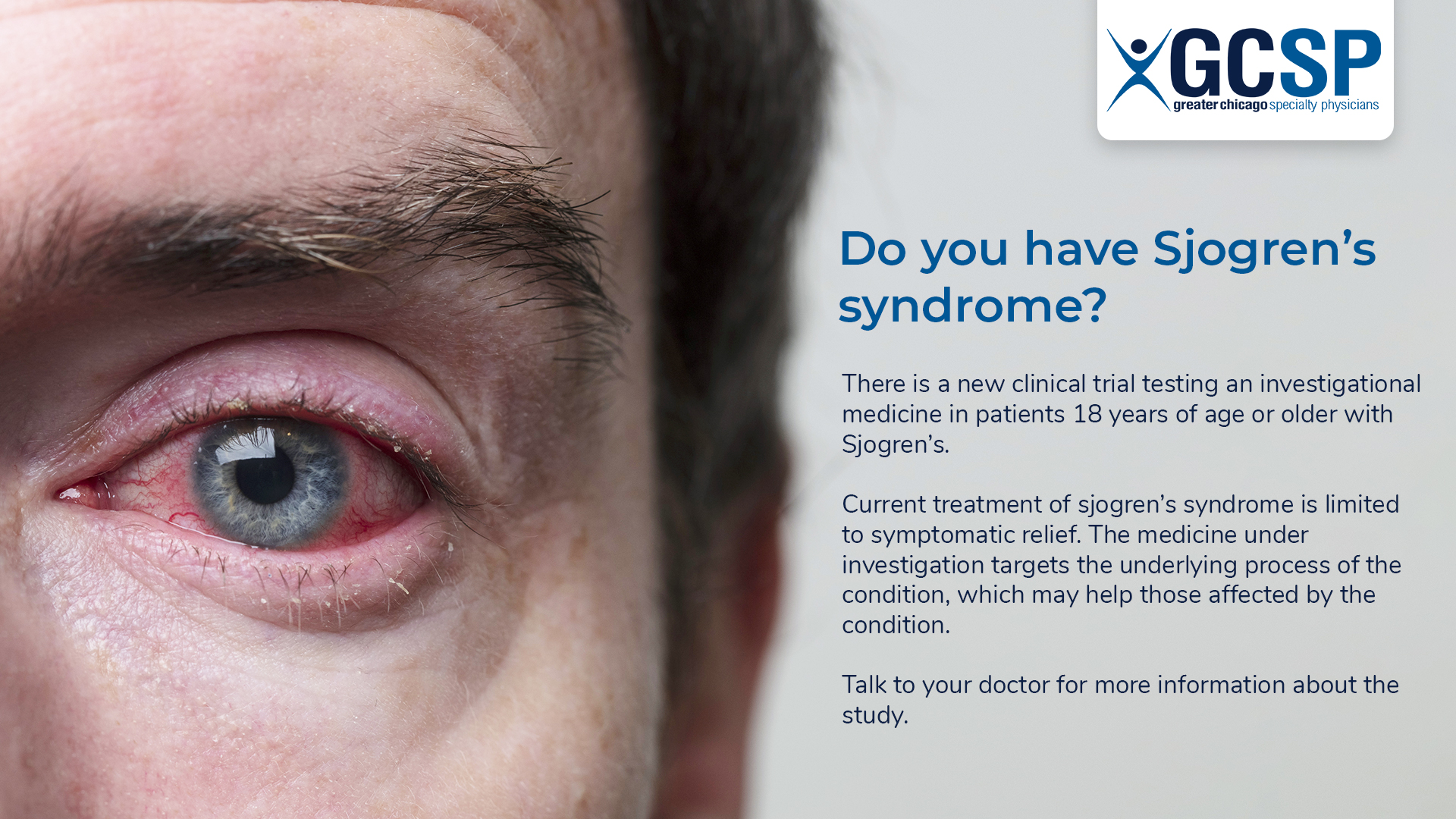 sjogren-syndrome-Clinical-Trial